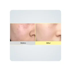 Crema regenerante Post-acné Dr. Althea 345 Relief Cream