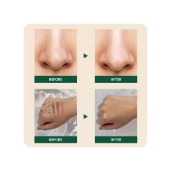 Seoul 1988 Cleansing Oil: Pine Cica 1%+Probiotics