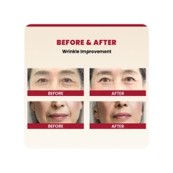 Seoul 1988 Cream: Retinal Liposome 1% + Fermented Rice