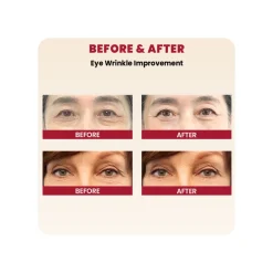 Seoul 1988 Eye Cream: Retinal Liposome 4% + Fermented Bean