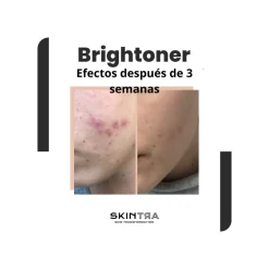 Tónico Exfoliante Iluminador SkinTra Brightoner